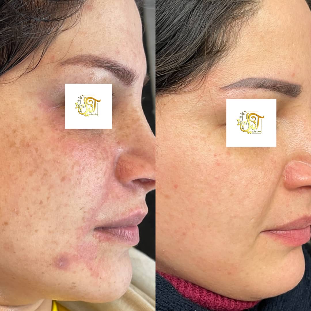 نمونه شماره3